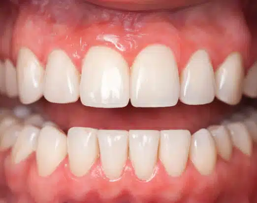 desues-tratamiento.periodontal