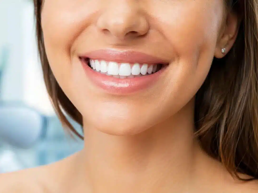 estetica-dental-en-villahermosa
